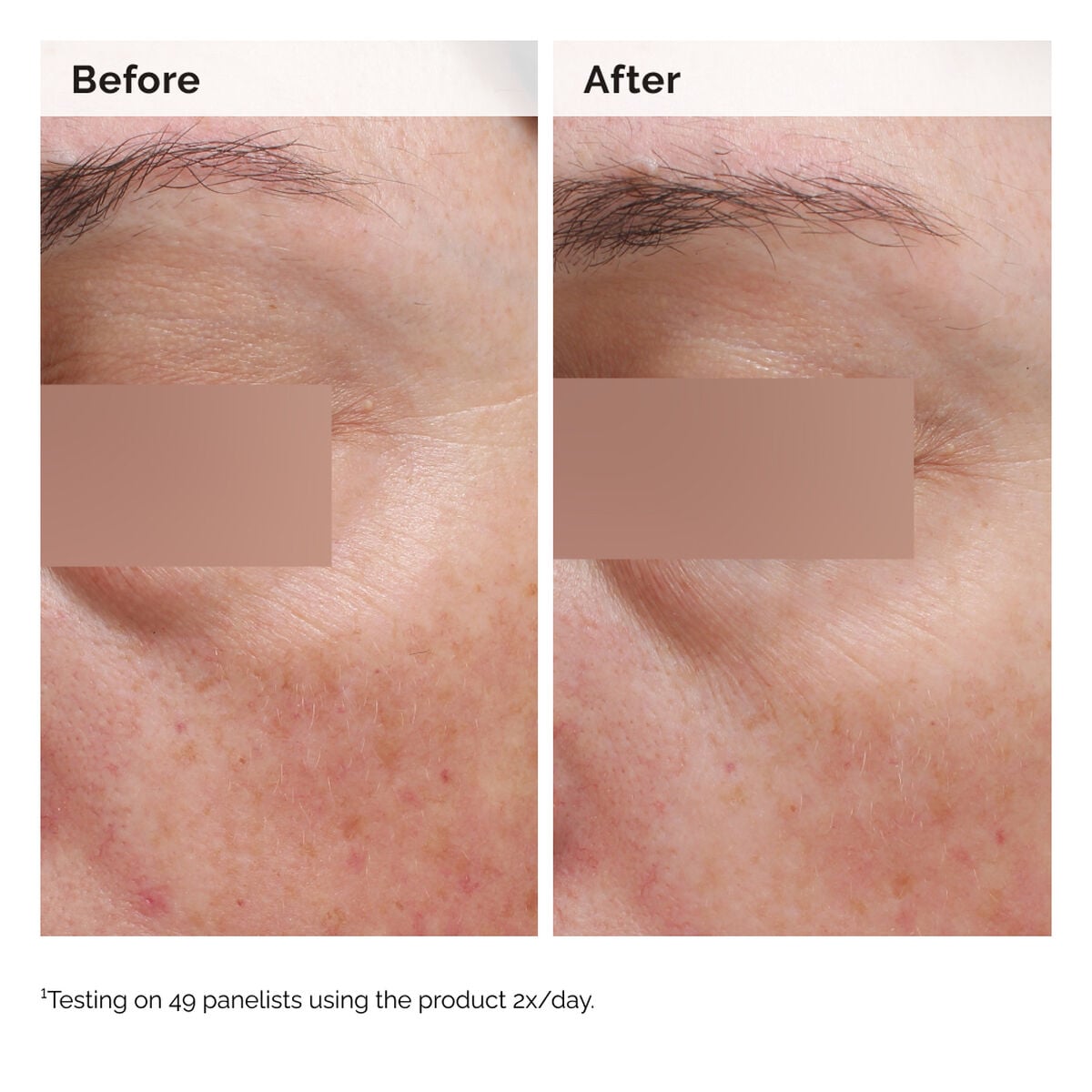 niacinamide-5-face-and-body-emulsion-l9 2024-08-23-ORD-Nia-5pct-Face-Body-B-A-Elasticity-Global-02-1x1.jpg