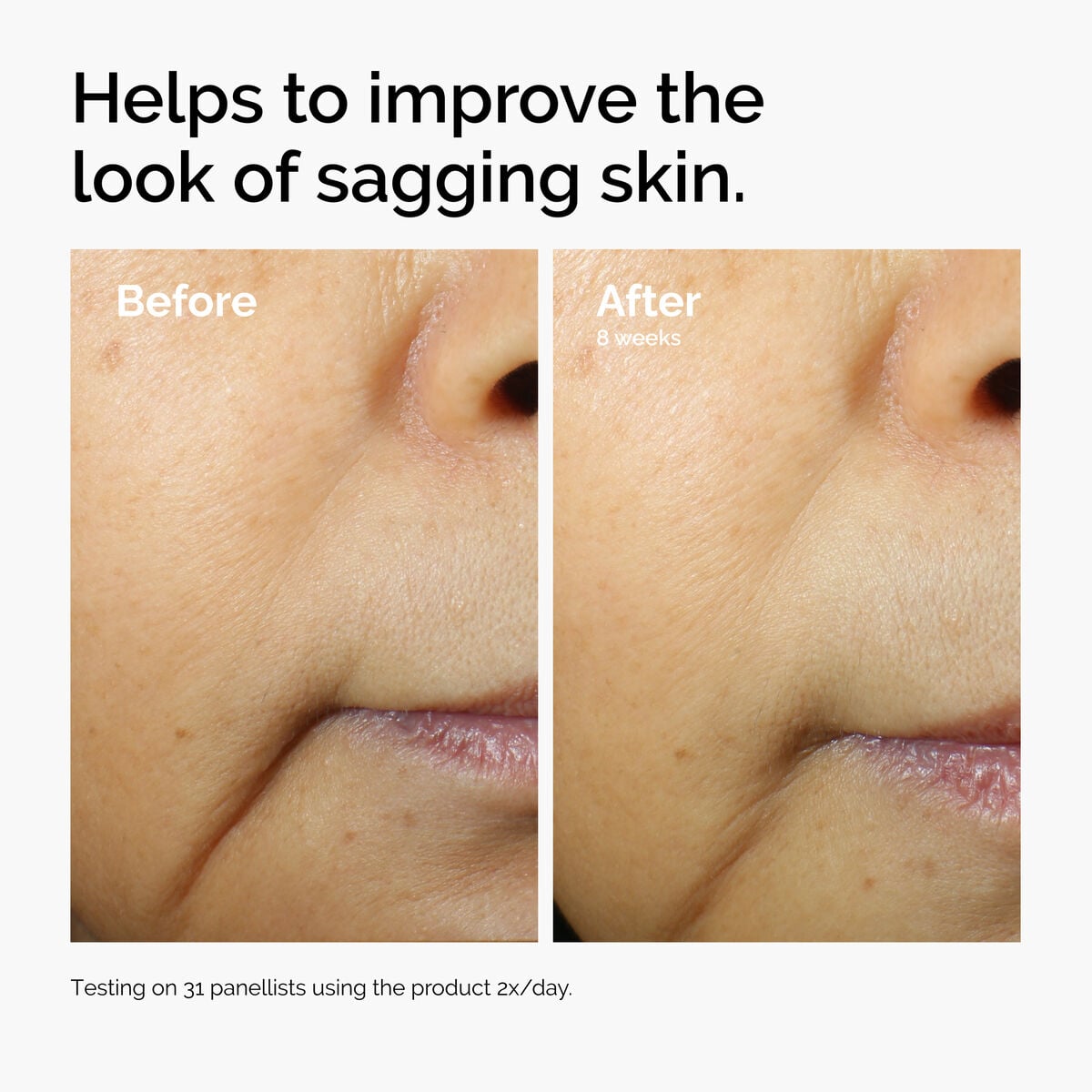 caffeine-3-escin-1-face-serum-h3 ord-caffeine-3pct-escin-1pct-face-serum-before-after-sagging.jpg