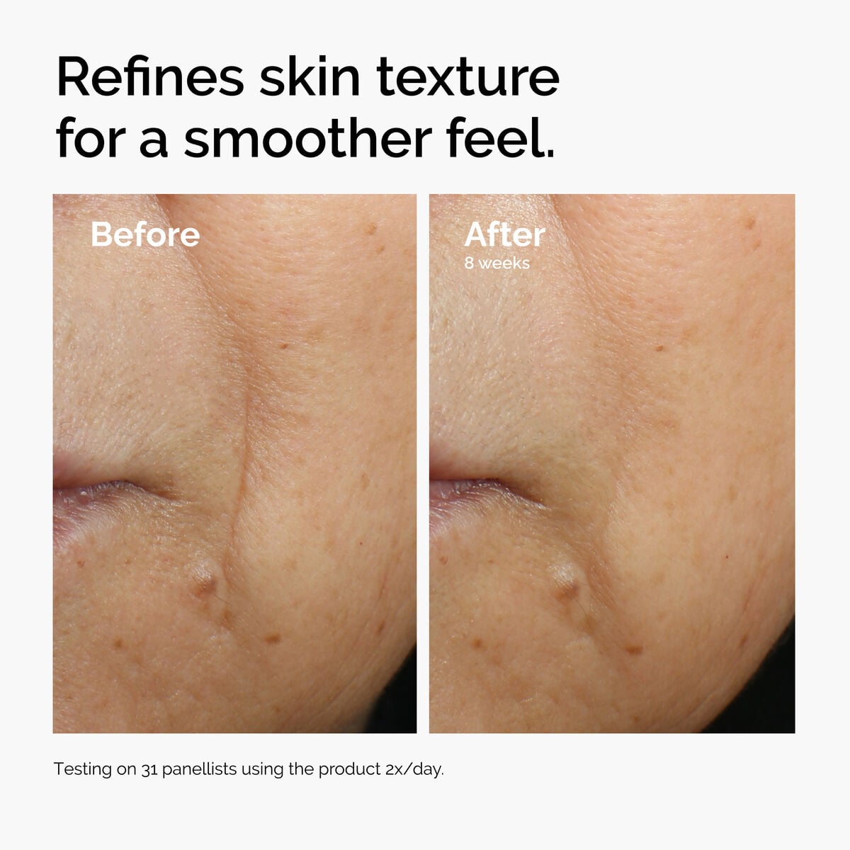 caffeine-3-escin-1-face-serum-h3 ord-caffeine-3pct-escin-1pct-face-serum-before-after-texture.jpg