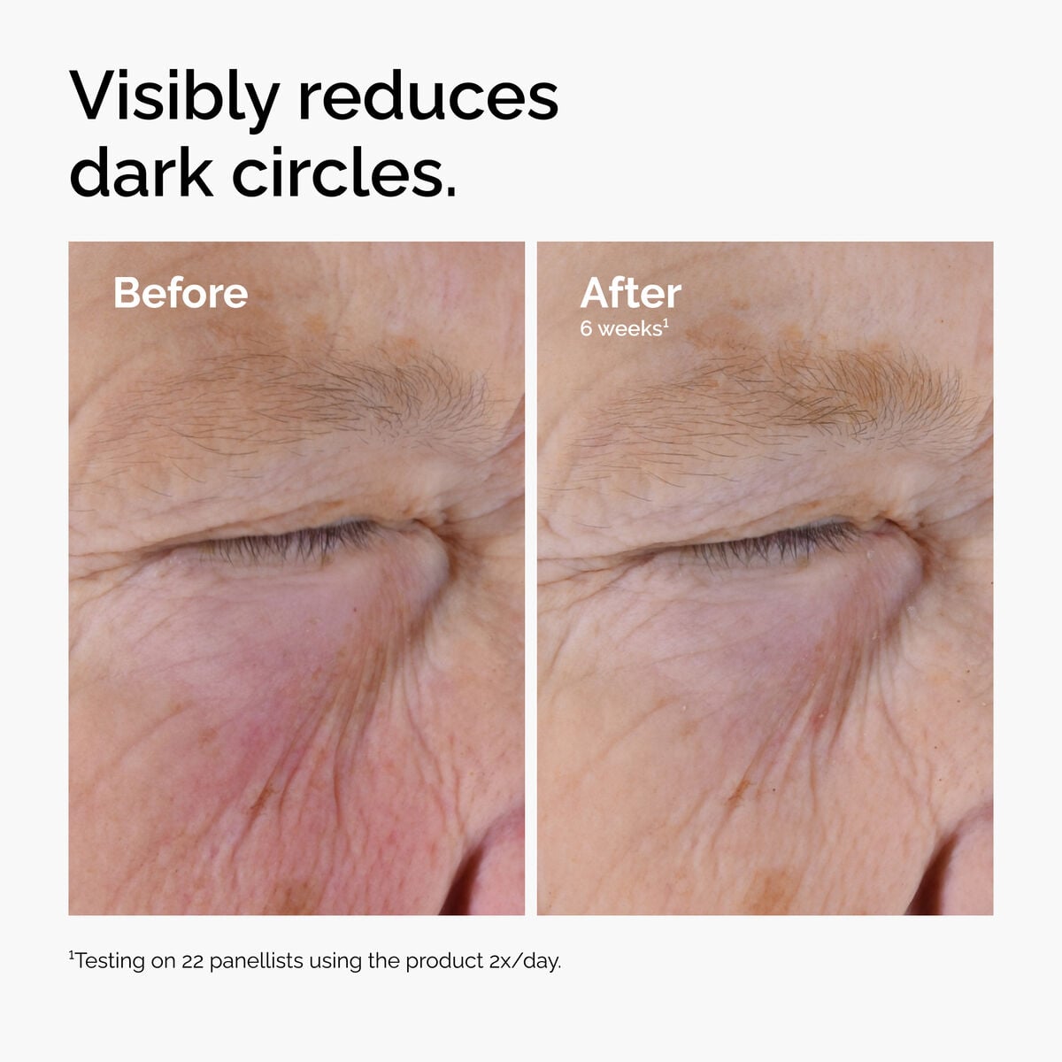 caffeine-solution-5-egcg-eye-serum-r3 ord-caffeine-solution-egcg-dark-circles-before-after.jpg
