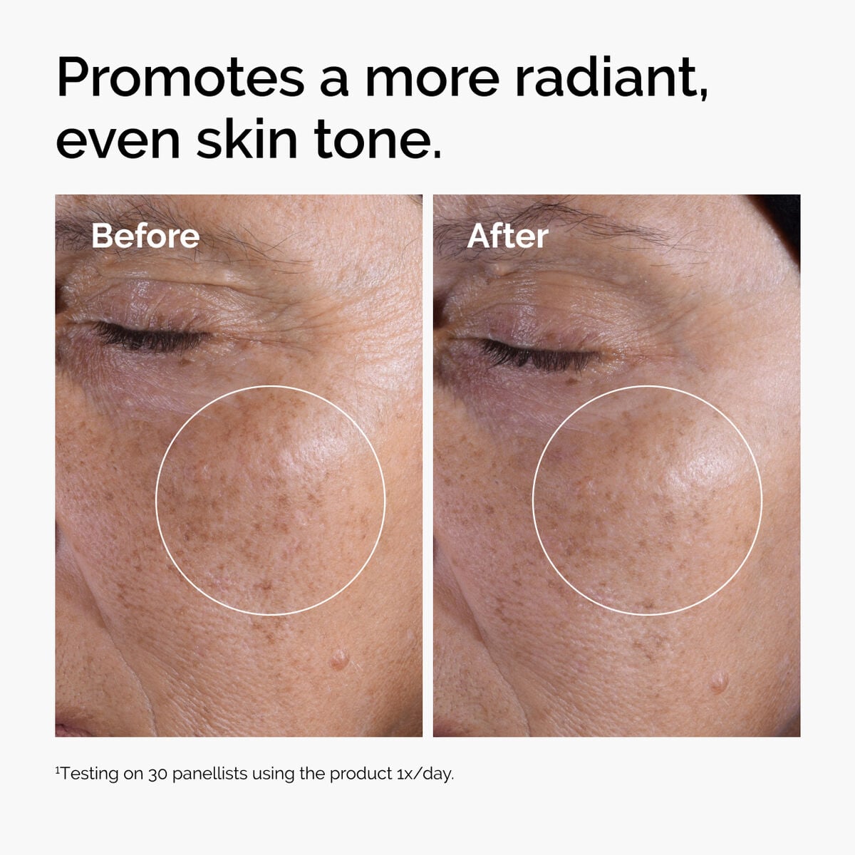 glycolic-acid-7-exfoliating-toner-b2 ord-glycolic-before-after-radiance.jpg