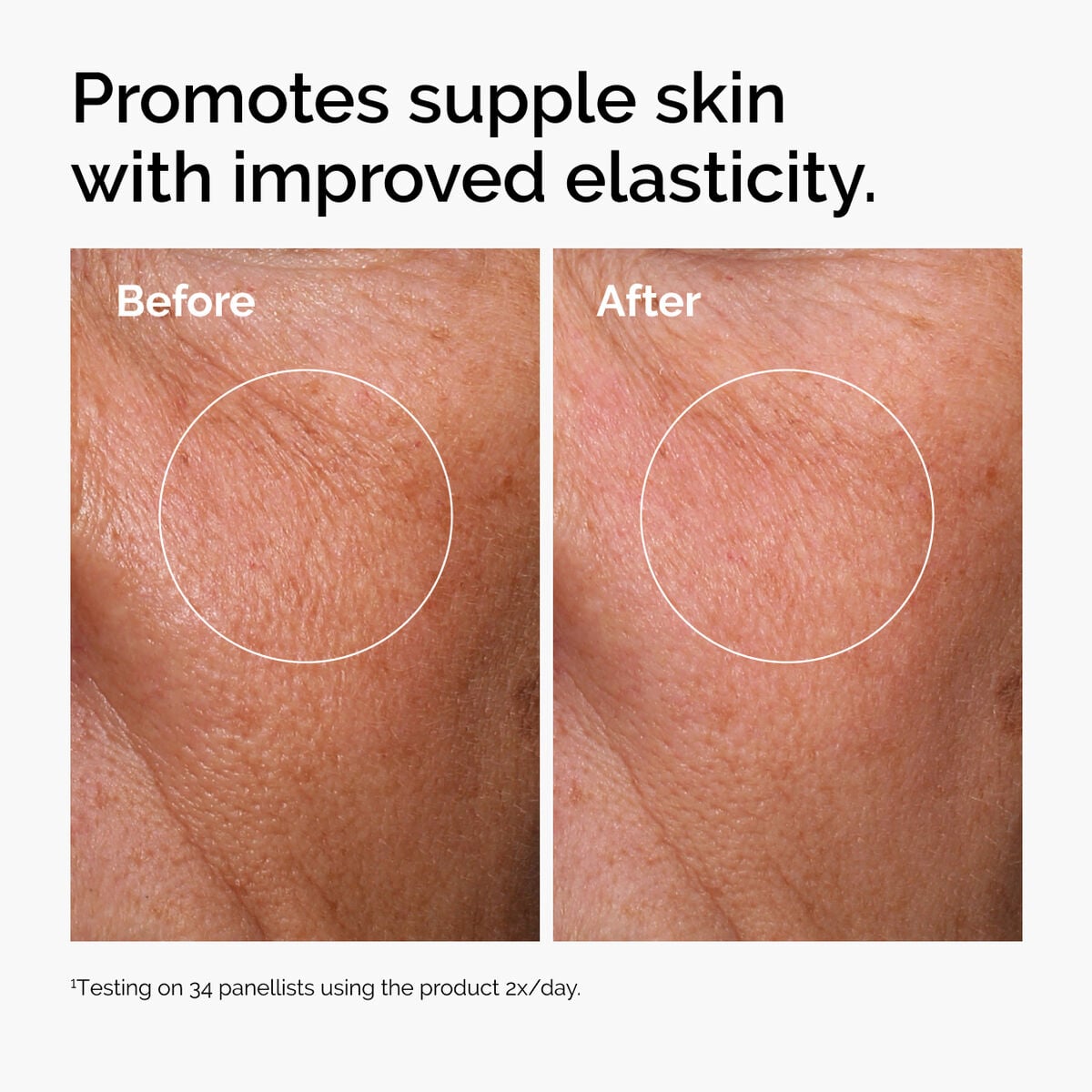 hyaluronic-acid-2-b5-with-ceramides-g0 ord-hyaluronic-acid-2pct-b5-hydrating-serum-before-after-elasticity.jpg