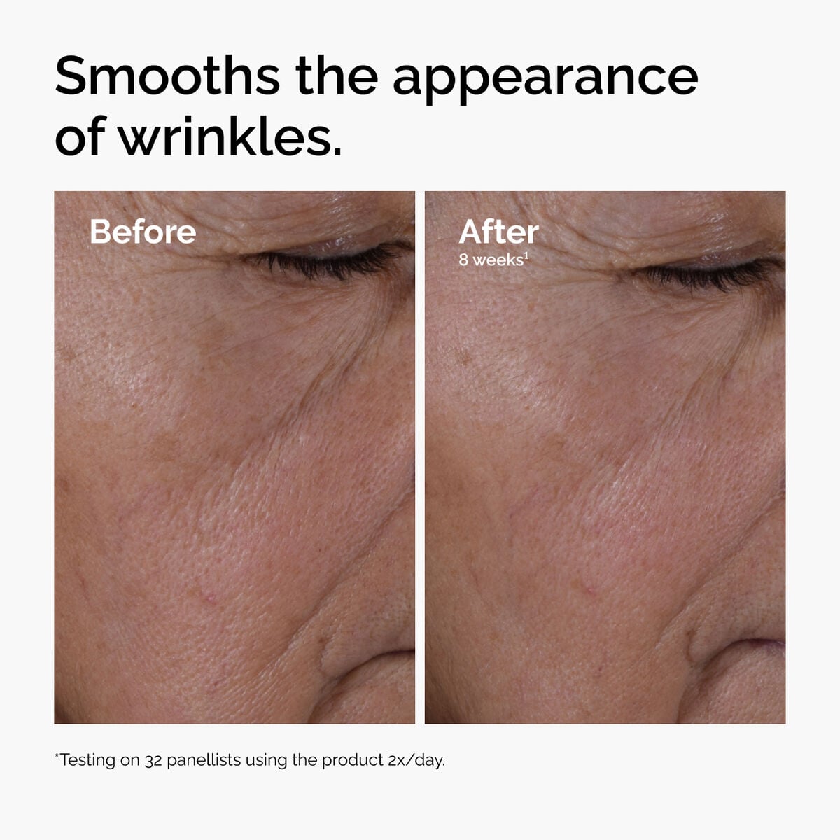 multi-peptide-ha-serum-n6 ord-multi-peptide-ha-serum-wrinkles-before-after.jpg
