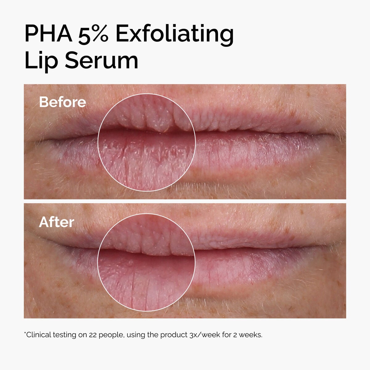 pha-5-exfoliating-lip-serum-v7 ord-pha-5pct-lip-exfoliating-serum-before-after.jpg