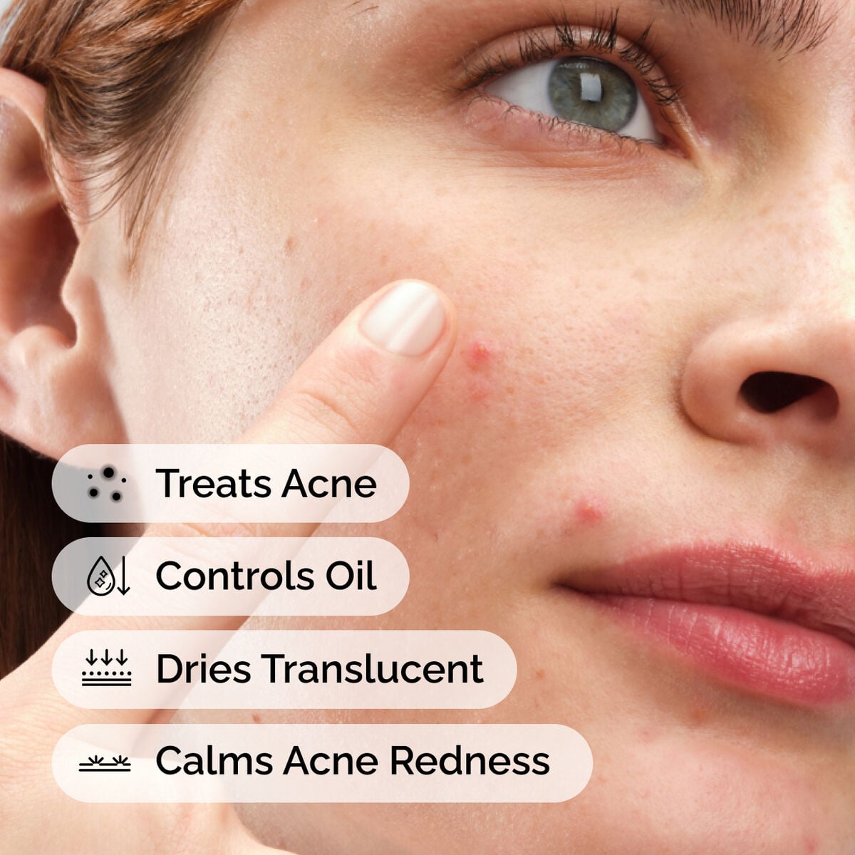 sulfur-10-powder-to-cream-concentrate-x4 ord-sulfur-10pct-powder-to-cream-concentrate-model-application-with-benefits-acne.jpg